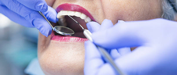Best Emergency Root Canal Treatment in Riverdale, GA